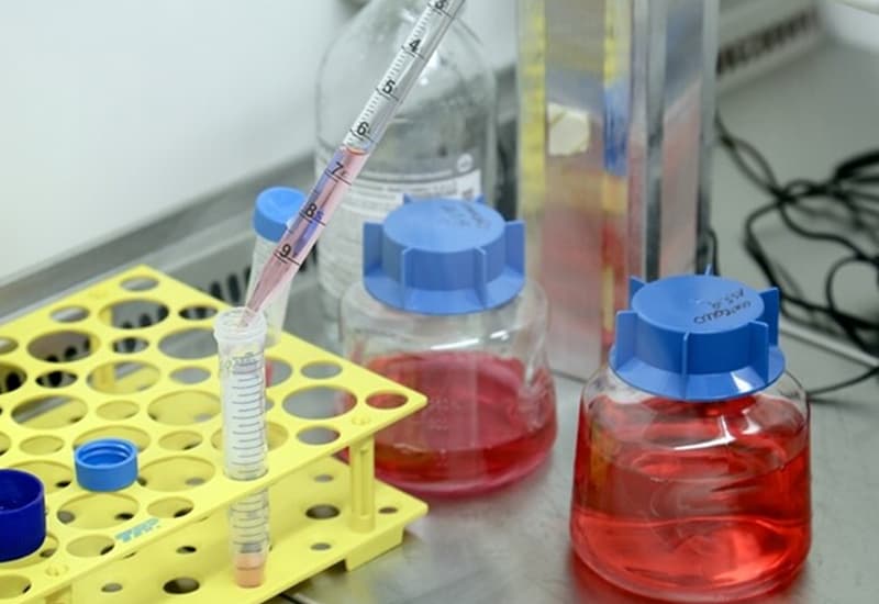 Prima prova del danno da nanoplastiche sull'uomo, raddoppiano i rischi al cuore
